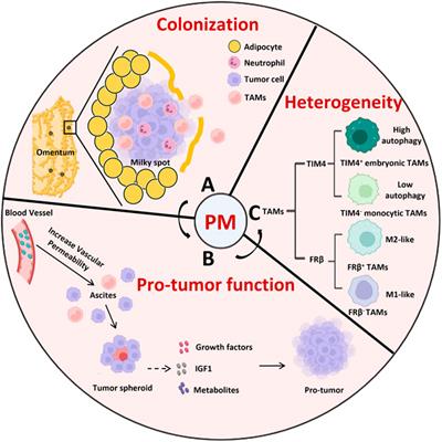 Peritoneal resident macrophages in tumor metastasis and immunotherapy